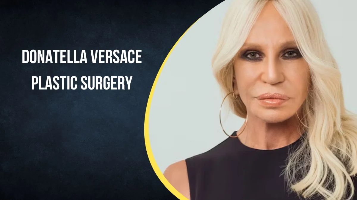 Donatella Versace Plastic Surgery