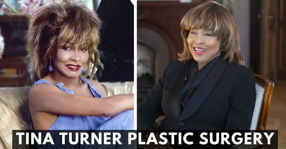 Tina Turner Plastic Surgery