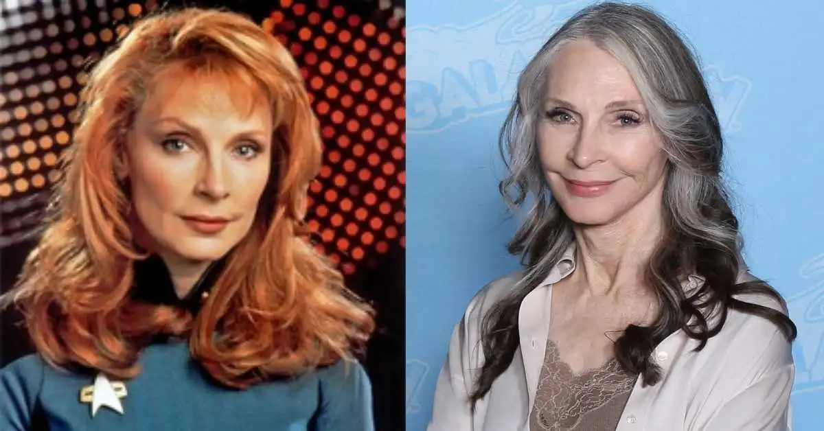 gates mcfadden plastic surgery