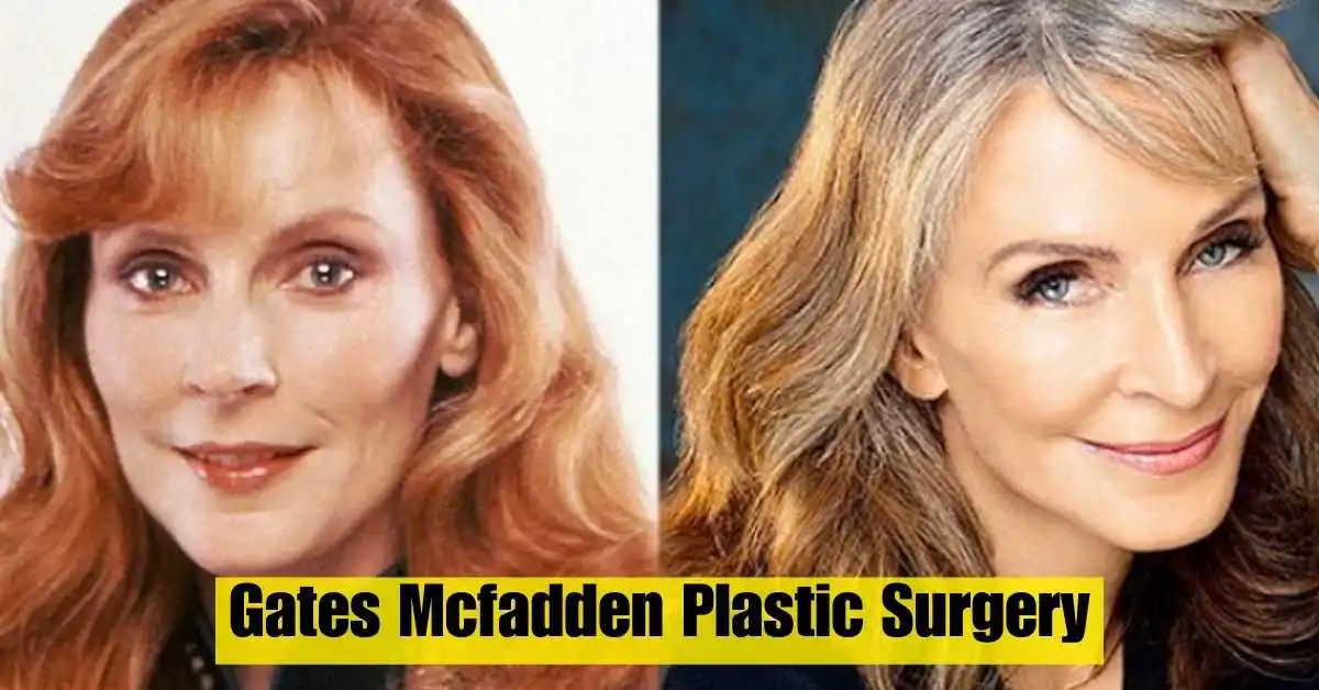 gates mcfadden plastic surgery