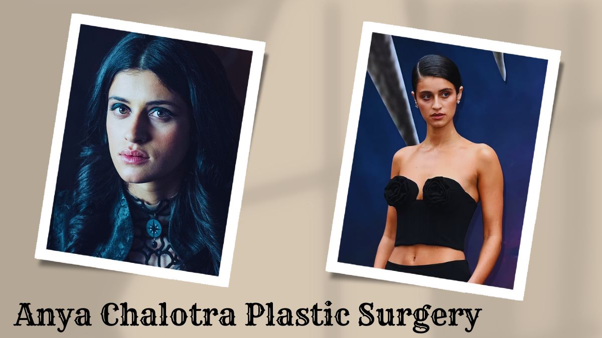 Anya Chalotra Plastic Surgery