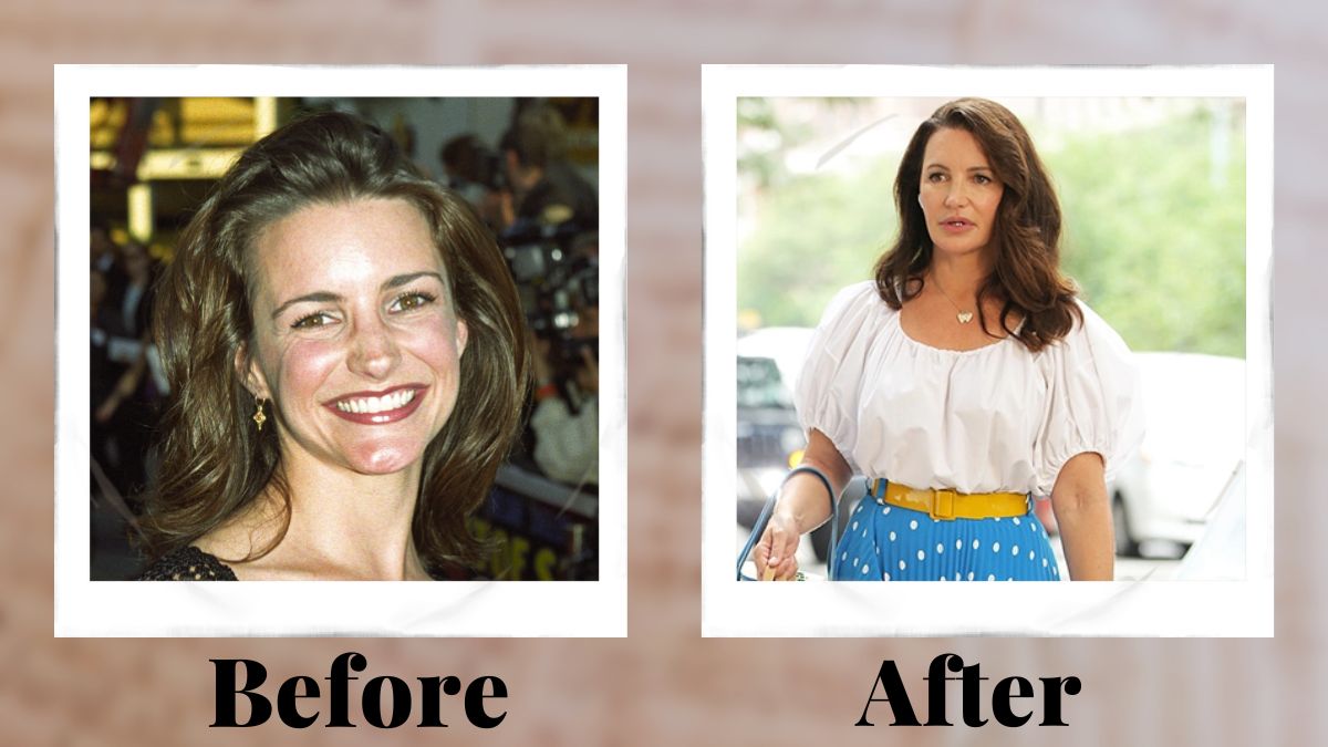 Kristin Davis Plastic Surgery