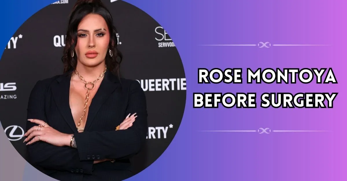 Rose Montoya Before Surgery