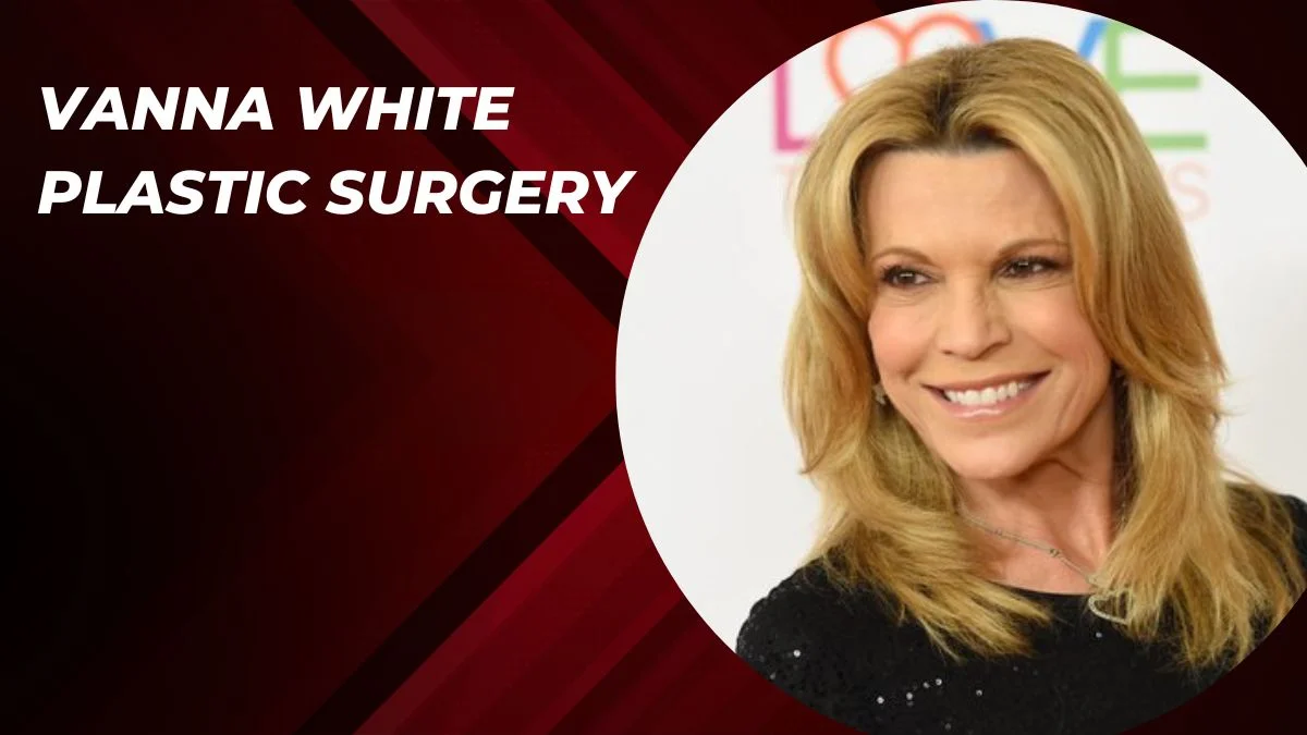 Vanna White Plastic Surgery