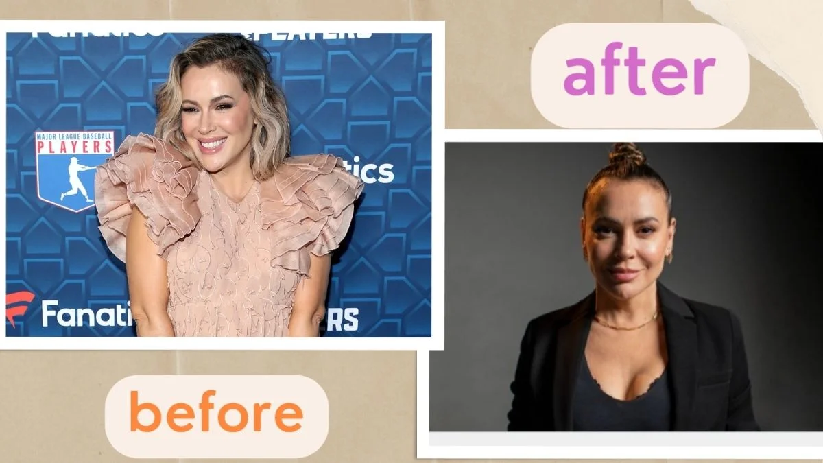 Alyssa Milano Breast Implant