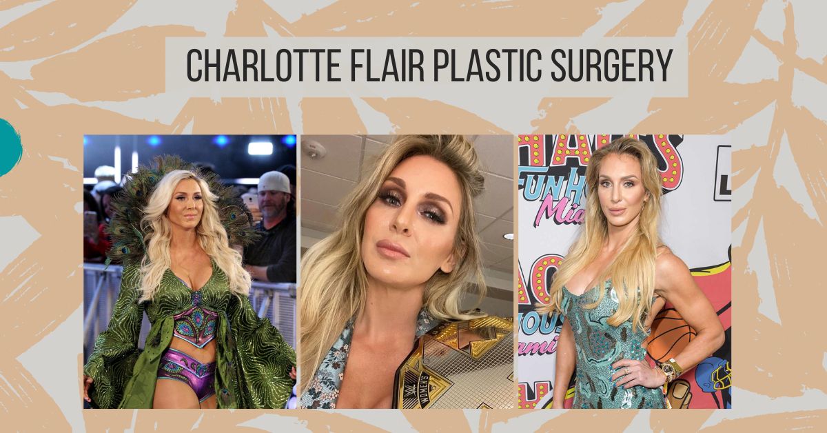 Charlotte Flair Plastic Surgery: New Look Of “The Queen”