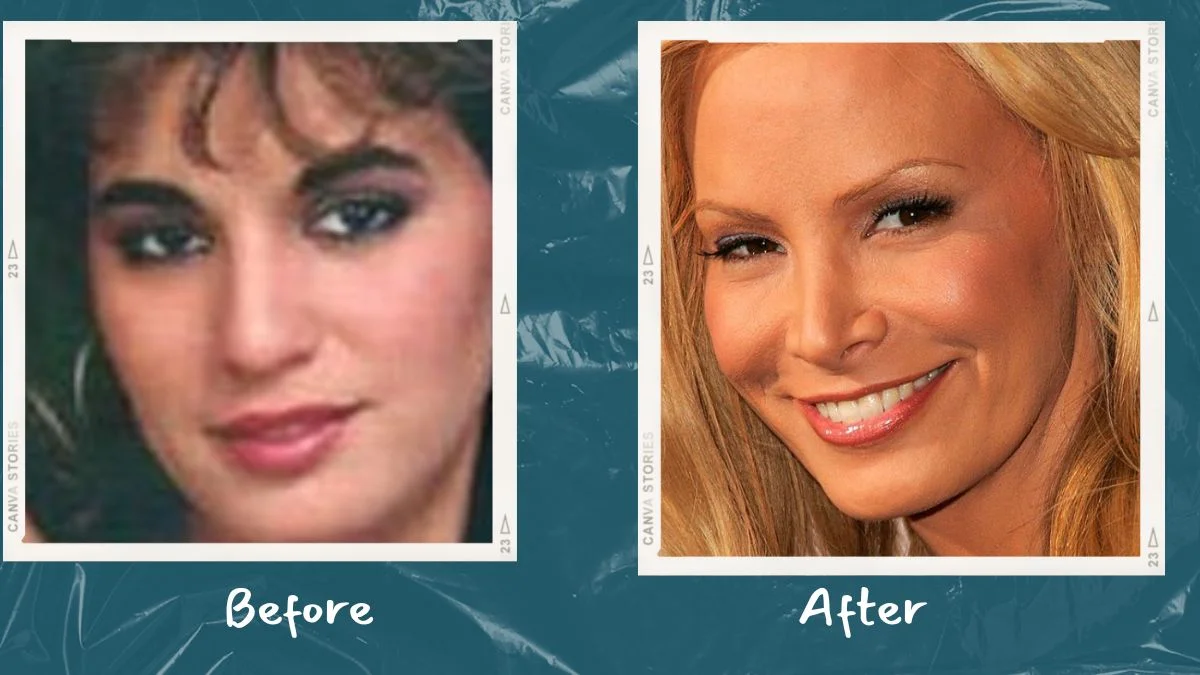 Cindy Margolis Nose Plastic Surgery