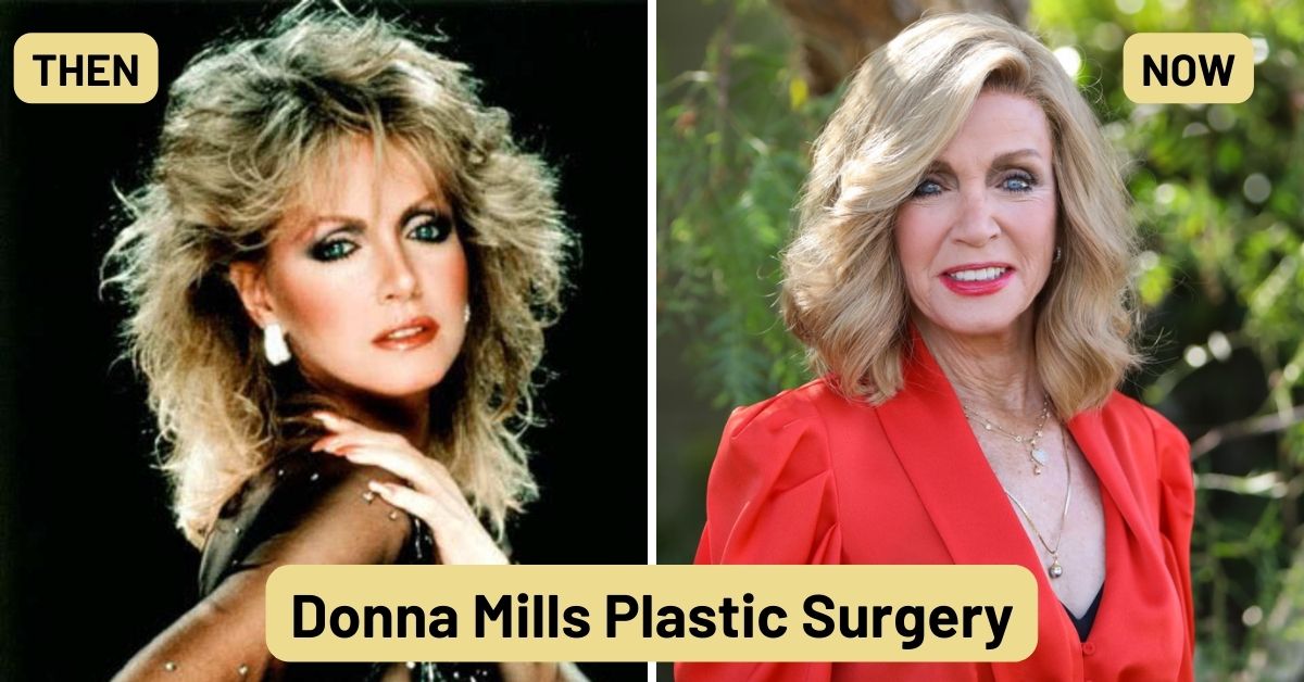 Donna Mills Plastic Surgery?