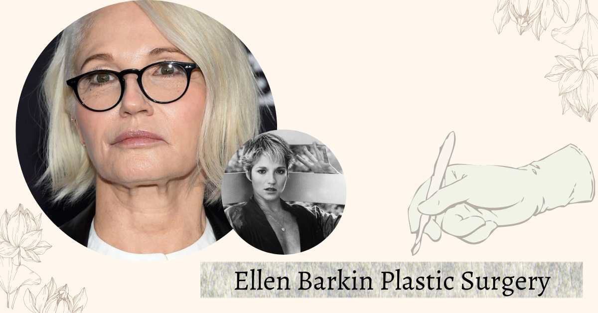 Ellen Barkin Plastic Surgery: Her Stunning Transformation Revealed!