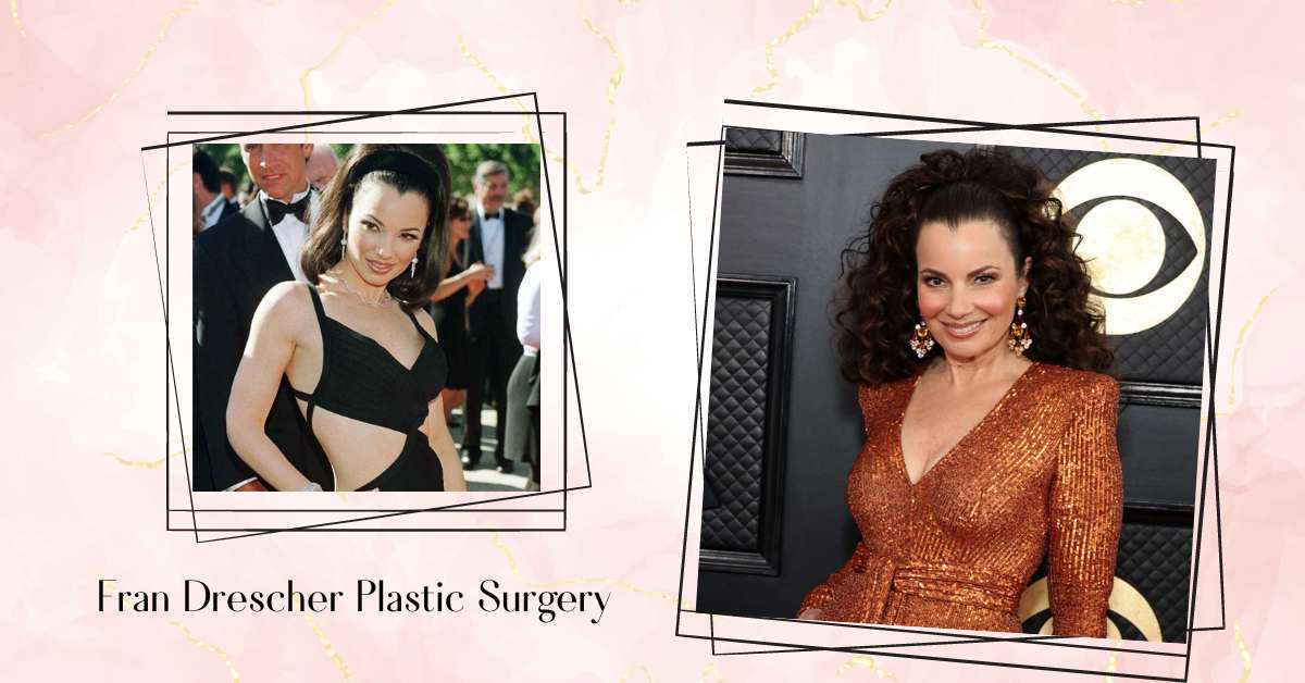 Fran Drescher Plastic Surgery: Truth Behind The Rumors!