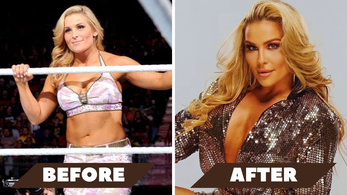 Natalya Plastic Surgery