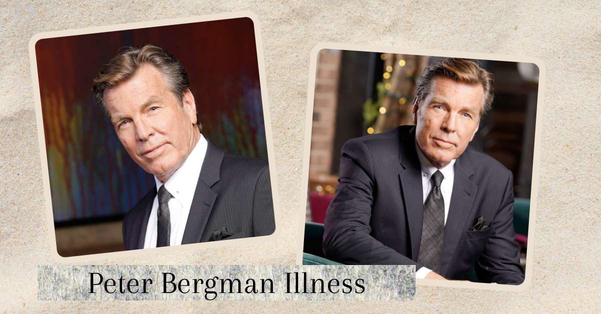 Peter Bergman Illness: What Kind Of Surgery Did He Have?