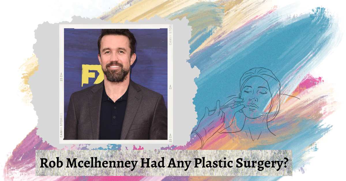 Rob Mcelhenney Had Any Plastic Surgery? Revealing The Truth!