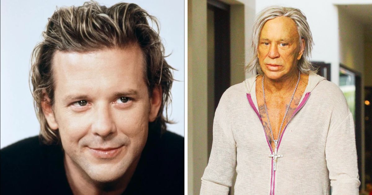 What Happened to Mickey Rourke's Face?