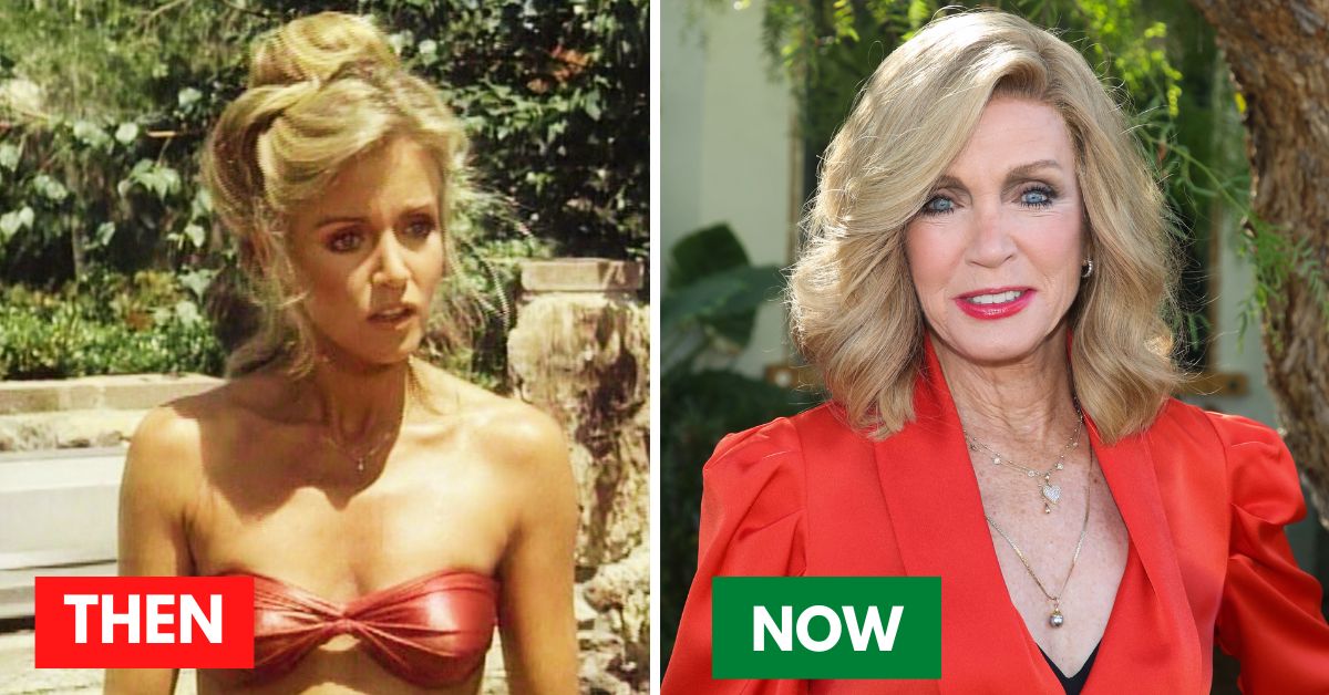 donna mills plastic surgery