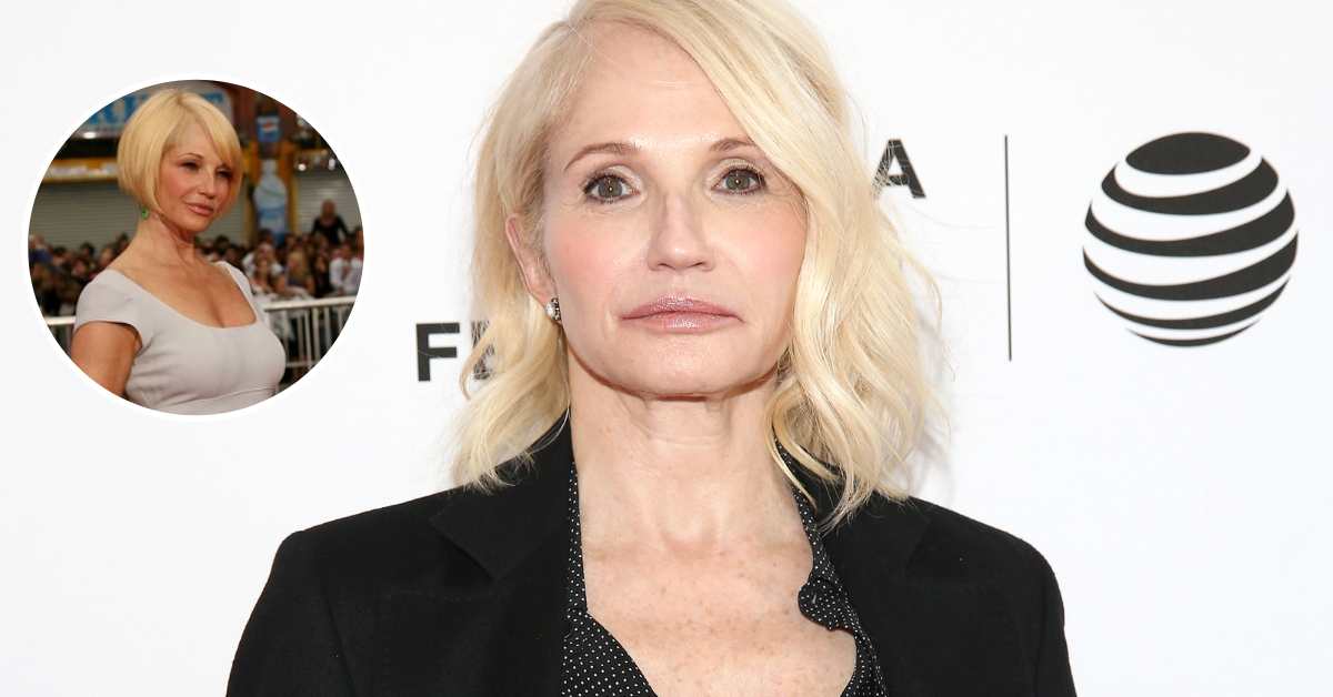 ellen barkin plastic surgery