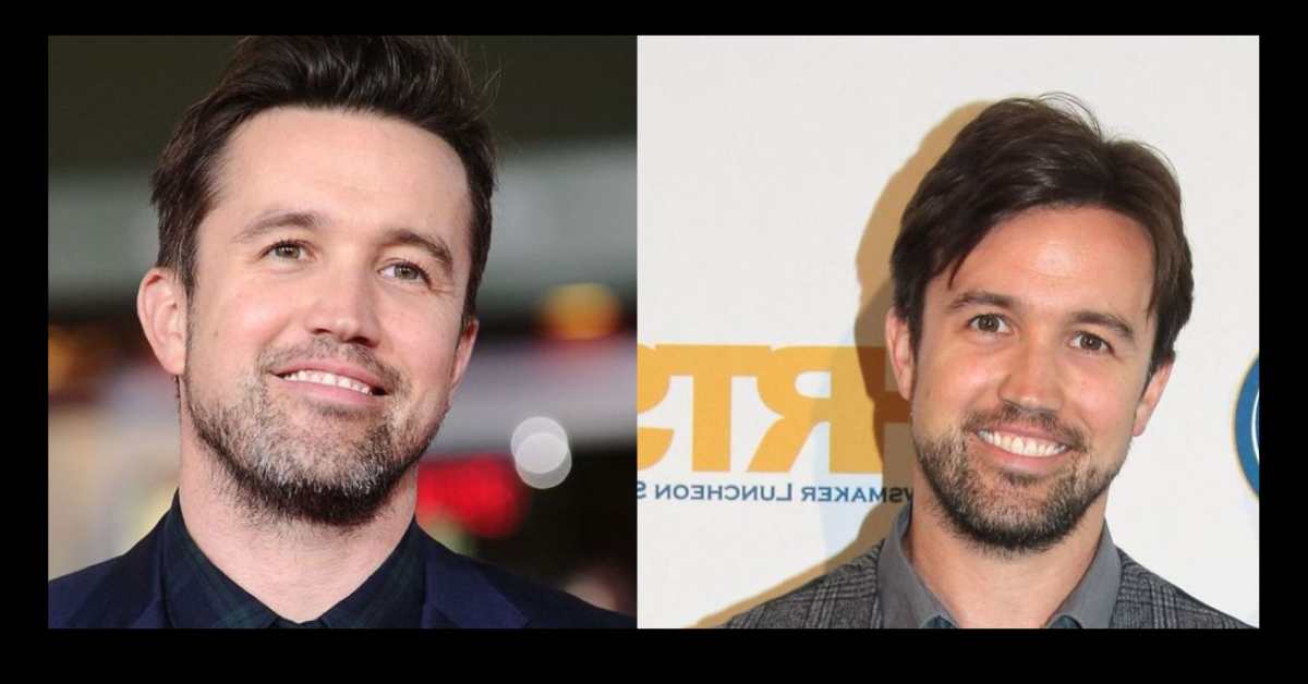 rob mcelhenney plastic surgery