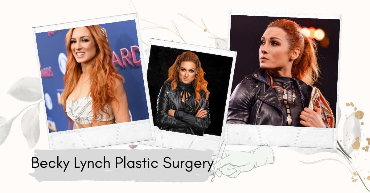 Becky Lynch Plastic Surgery: The Truth Revealed!