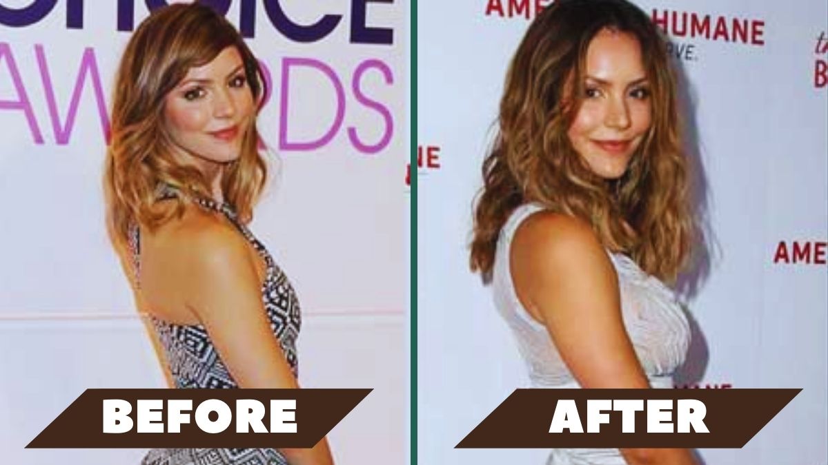 Katharine McPhee Plastic Surgery