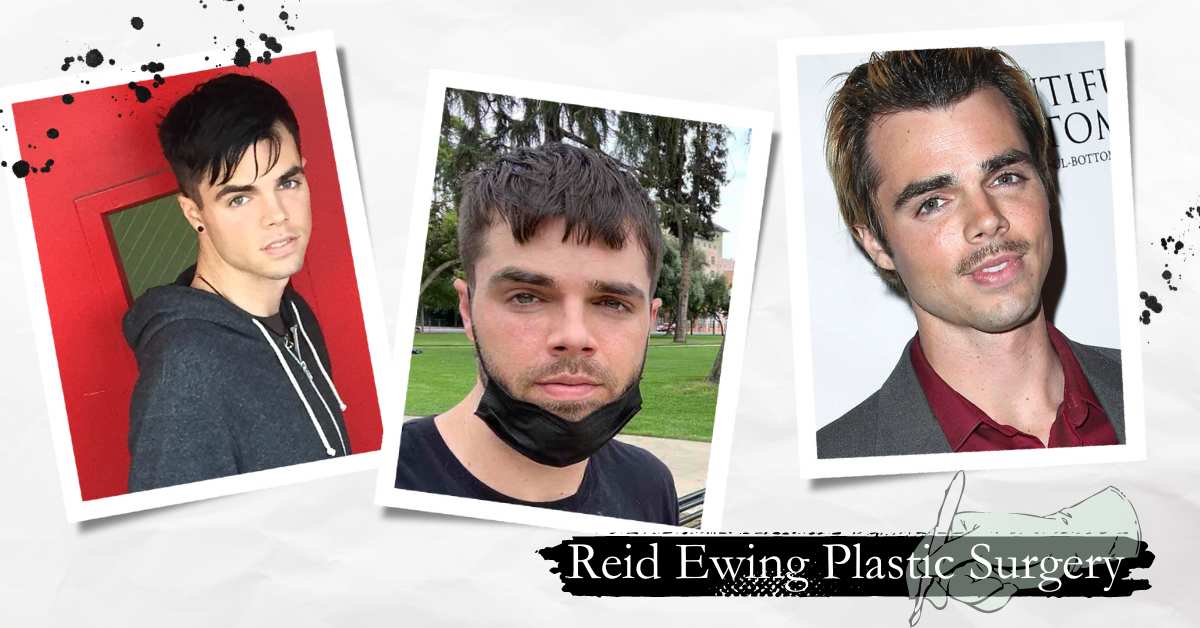 Reid Ewing Plastic Surgery: Is It True, Or Fans Simply Spread Rumors?