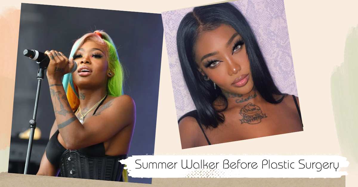 Summer Walker Before Plastic Surgery: From Pure To Improved