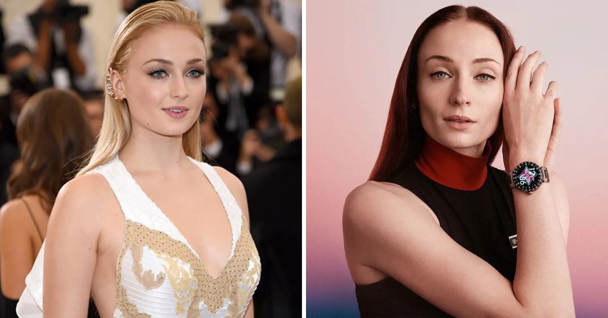 Sophie Turner Plastic Surgery