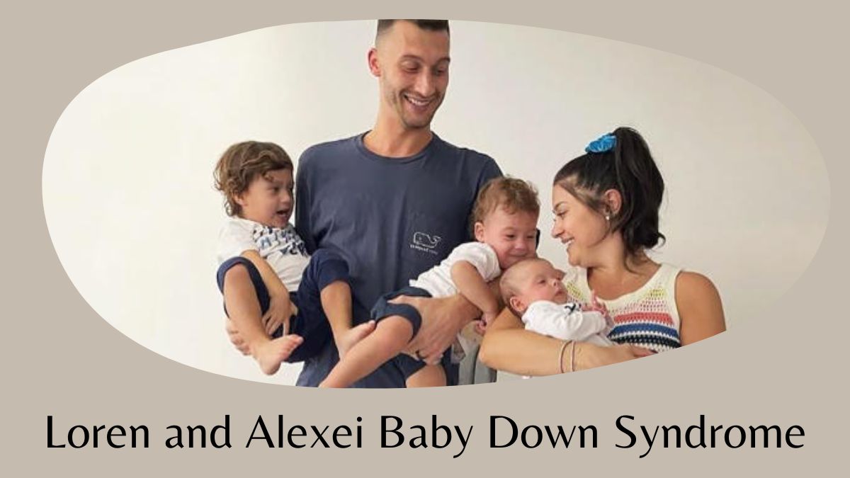 loren and alexei baby down syndrome