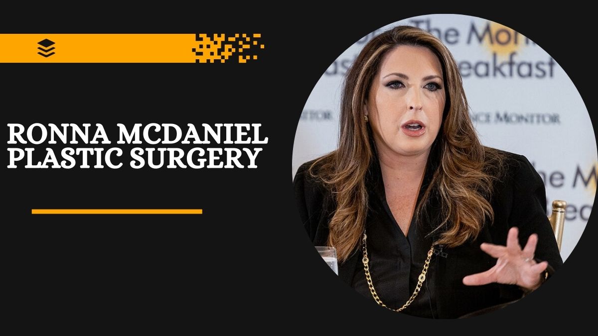 Ronna McDaniel Plastic Surgery