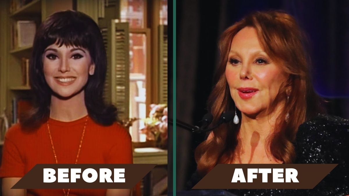 Marlo Thomas Plastic Surgery