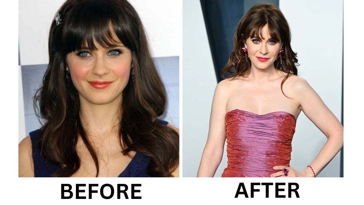 Zooey Deschanel’s Plastic Surgery 