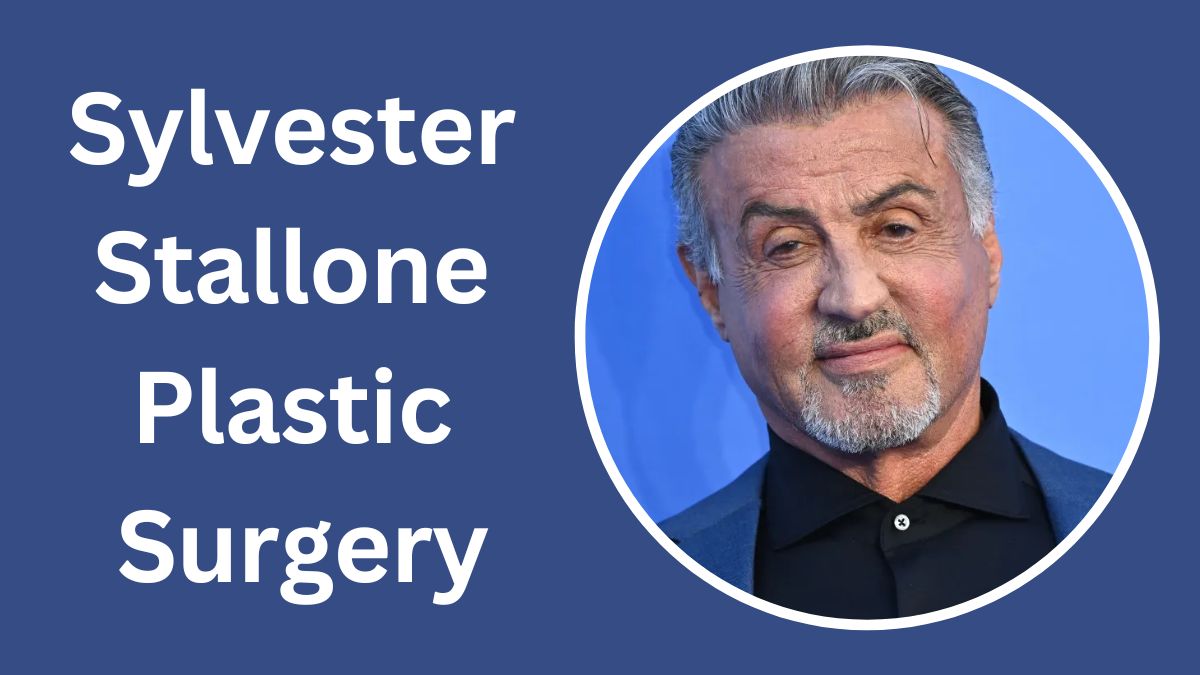 Sylvester Stallone Plastic Surgery