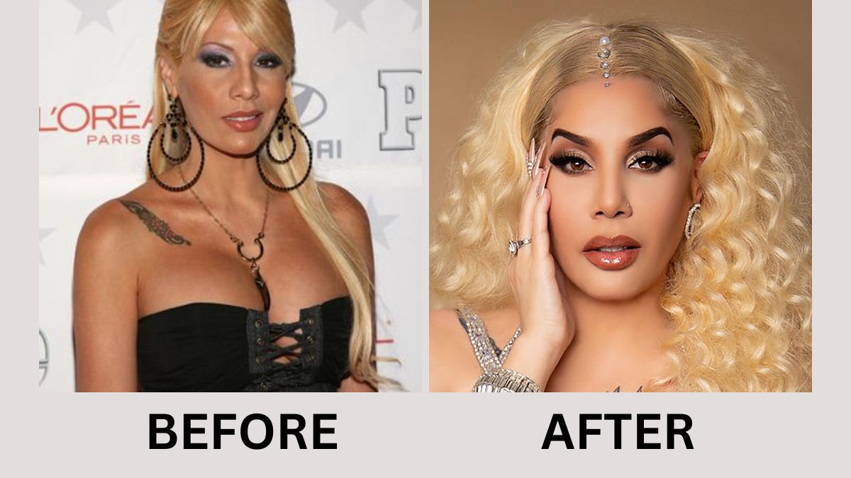 Ivy Queen Plastic Surgery