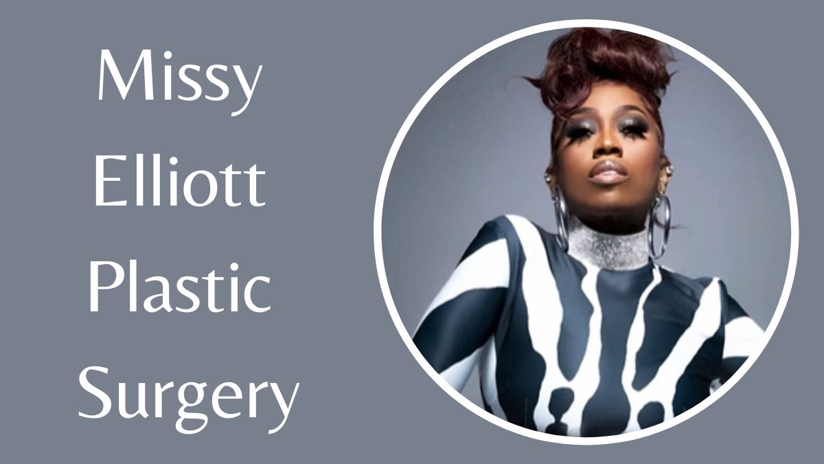 Missy Elliott Plastic Surgery