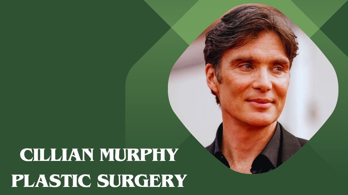 Cillian Murphy Plastic Surgery