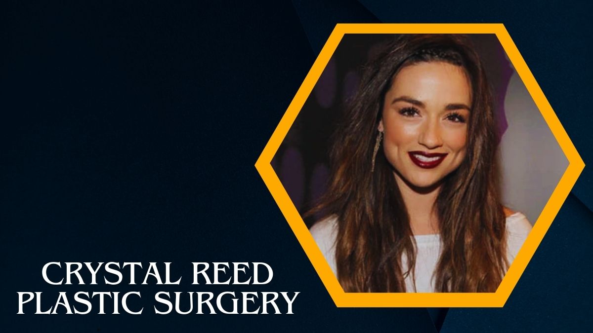 Crystal Reed Plastic Surgery