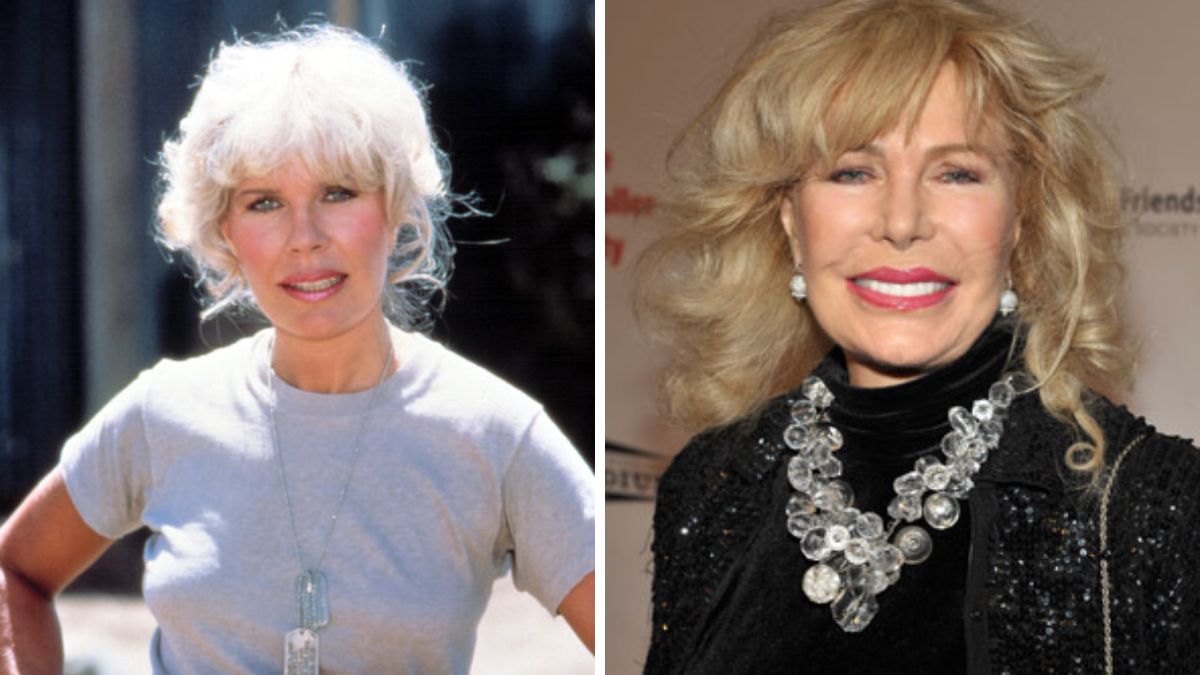 Loretta Swit Plastic Surgery