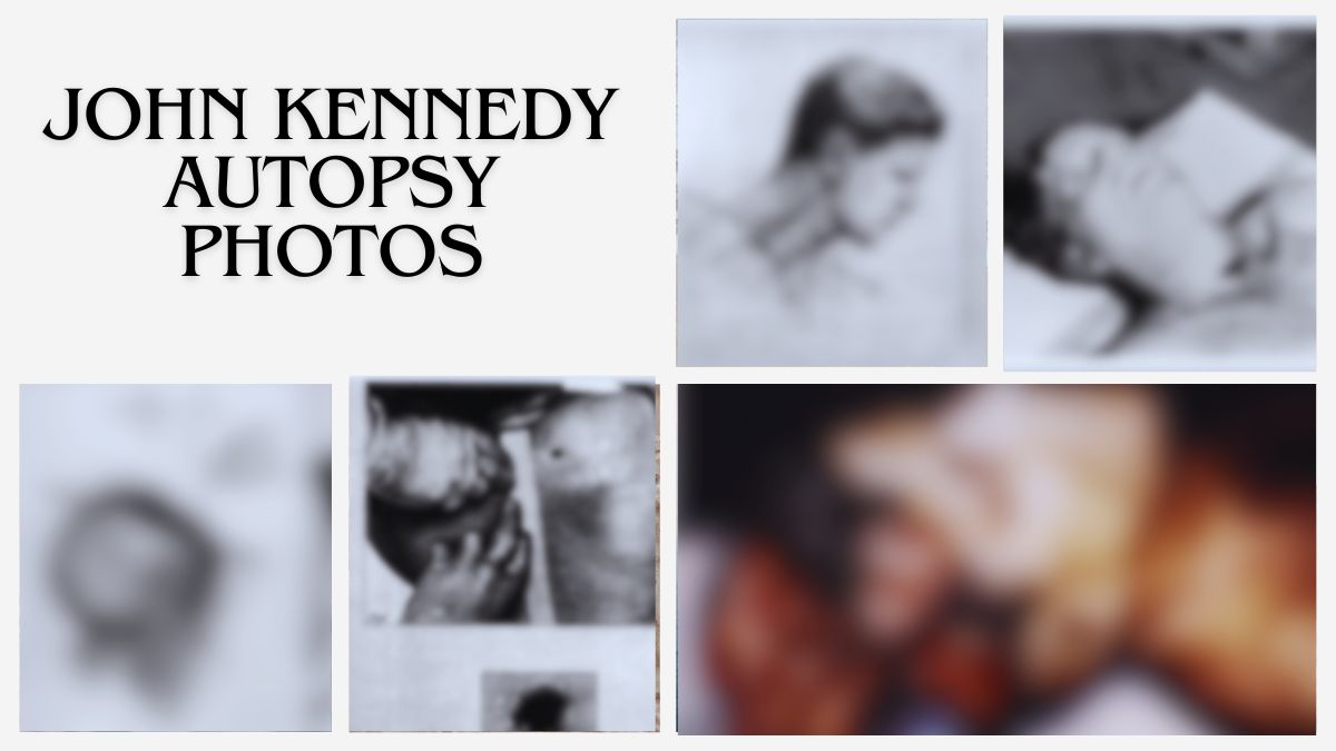 John Kennedy Autopsy Photos (Image Source: Wikipedia)